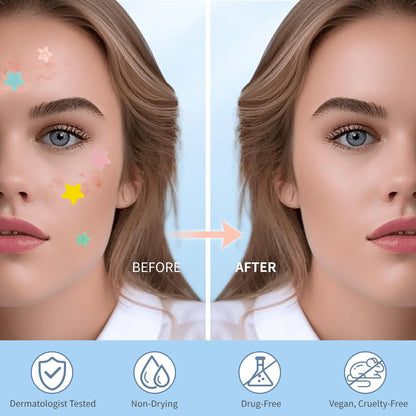 QUSTERE Pimple Patches for Face, Hydrocolloid Acne Patches, Cute Star Zit Covers, Colorful Spot Stickers with Tea Tree, Salicylic Acid & Cica Oil| 3 Sizes (10Mm, 12Mm & 14Mm) |200 Count Skincare Skin Repair